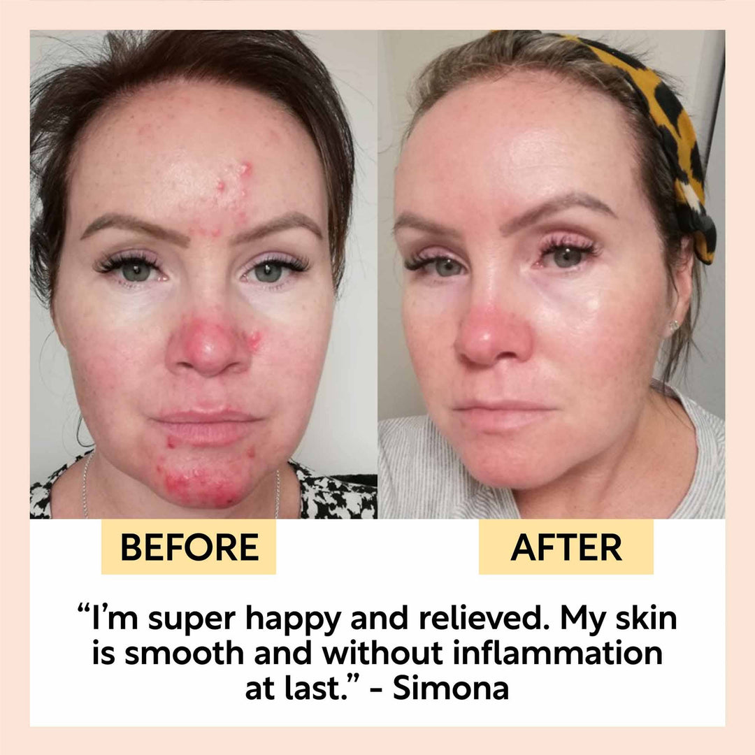 Night Cream with Hyaluronic Acid + Niacinamide - Travel Size